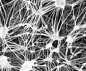 cable membrane